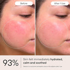 Alpyn Super Peptide & Ghostberry Moisturizer for Eczema, Barrier & Wrinkle Repair | Calm & Soothe Against Redness & Irritation | 1.7 oz / 50 ml