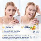 HIQILI 100ML Turmeric Oil for Face Skin Care, Aromatherapy,100% Pure, Use After Dilution- 3.38 Fl Oz