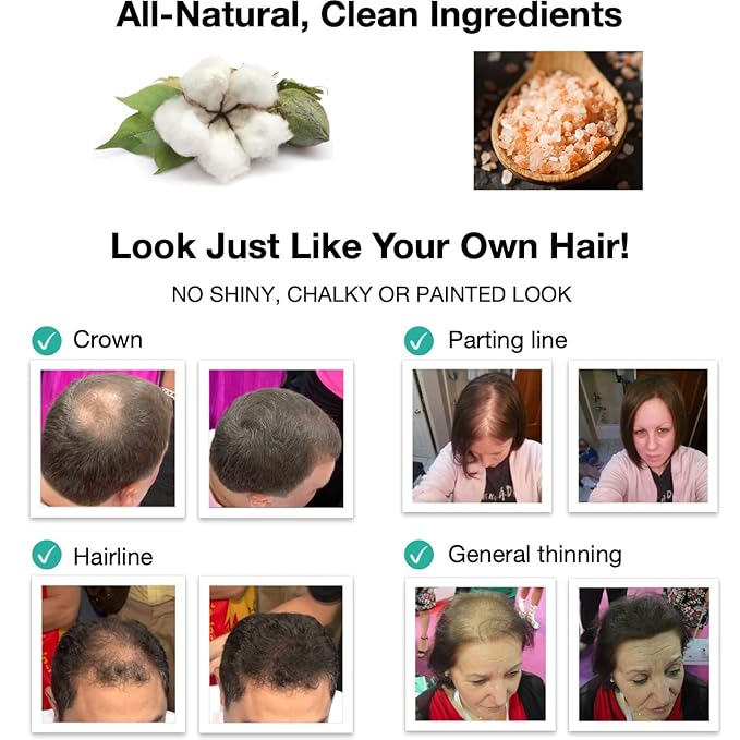 Hair Building Fibers. Cover Bald Spot and Thinning Hair. All-Natural, Plant-Based (Trial Size, 10-Day Supply). Golden Blonde