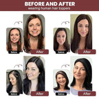 YAMI Real Human Hair Toppers for Women, 12 Inch, Dark Brown, Swiss Lace Base, Medium Density, Full Top Coverage, Clips Attachment