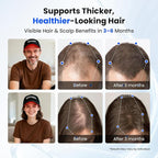 Red Light Hair Growth Cap, Red Light Therapy for Hair Growth, 528 LEDs, 4 Modes & 3 Levels, Portable Rechargeable Hair Care Cap with 5000mAh Remote for Men & Women