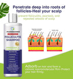 Anti-Fungal Shampoo for Folliculitis, Seborrheic Dermatitis, Scalp Psoriasis - Relieves Itchy & Dry Scalp