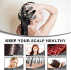 Silicone Scalp Massager, Scalp Scrubber for Hair Growth with Soft Bristles, Scalp Exfoliator Brush Dandruff Removal Shampoo Brush for Wet Dry Scalp Care (Black)