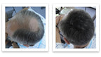 Trial Size - Eliminate Bald Spot and Thinning Hair Instantly. Make Thin Hair Look 10X Fuller. All-Natural Hair Thickening Fiber. Salt & Pepper - Dark
