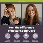Marie Originals Eczema & Psoriasis Nourishing Shampoo and Conditioner Bundle – Itchy Scalp Relief, Dry Scalp Shampoo & Hydrating Conditioner with Tea Tree, Lavender & Peppermint – 8 oz Each