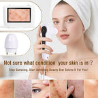 Scalp Camera, 5" HD Rechargeable Scalp and Skin Analysis Machine, Skin Microscope for Professional Facial & Hair Follicle Health Diagnosis - For Home, Salon, Spa