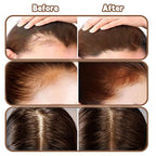 Root Touch Up Powder Hair Color Medium Brown, Root Cover Up Hair Powder for Women Scalp Concealer, HairlinePowder for Women GrayHair