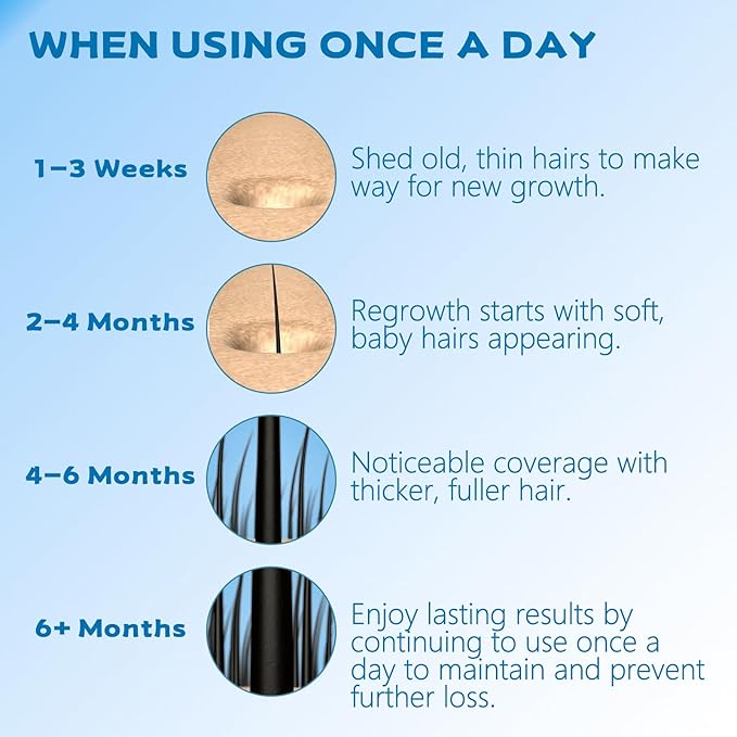 5% Minoxidil Foam for Men, Minoxidil for Women Hair Growth, Infused with Biotin, Hair Growth Treatment, Foam Hair Regrowth Treatment for Hair Thinning Receding Hairline,(2 oz Bottle), 3-Pack