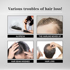 5% Minoxidil Hair Liquid for Men & Women, 2 x 3ml, with Ginseng & Ginger Root Extract - Hair Growth Supporting Treatment for Thinning Hair, Scalp Care Serum to Help Reduce Hair Loss Appearance
