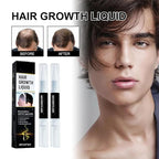 5% Minoxidil Hair Liquid for Men & Women, 2 x 3ml, with Ginseng & Ginger Root Extract - Hair Growth Supporting Treatment for Thinning Hair, Scalp Care Serum to Help Reduce Hair Loss Appearance