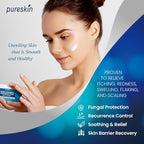 Seborrheic Dermatitis Psoriasis Cream: Antifungal Treatment - Traditional Herbal Infused - Relief for Flaking Irritated Scalp Skin - Steroids Free Lasting Result 3.4 Oz