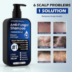 Antifungal Shampoo for Seborrheic Dermatitis, Folliculitis & Scalp Psoriasis, Anti-Dandruff Shampoo for Men & Women, Relieves Scalp Itching, Dryness, Sulfate & Paraben-Free, 10.1 Fl Oz-Fresh