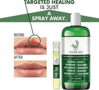 All Natural Eczema Treatment- Psoriasis Treatment - an All-in-One Solution for Acne, Dermatitis, Rosacea, Cold Sores, Pet Rashes, Bug Bites, and Poison Ivy - Anti-Itch Spray for Itchy Skin Relief