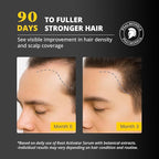 Hair Growth Serum: Root Activator Scalp Serum for Hair Loss and Regrowth Treatments – Natural Hair Oils for Hair Growth for Men Women (1 Fl Oz (Pack of 1))
