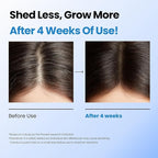 Scalpy Hair Growth Serum for Men & Women for Hair Loss & Regrowth | Scalp Treatment with Salicylic Acid, Menthol, Dexpanthenol | Non-Greasy, Lightweight (1.34 Fl Oz)