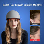 Laser Red Light Therapy for Hair Growth Device, FDA Cleared Hair Loss, Hair Growth Device