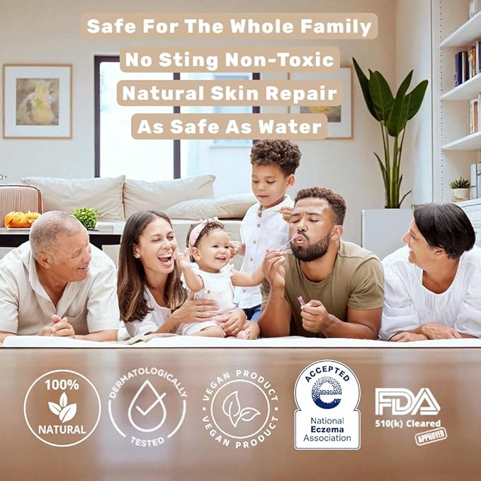 Loma Lux New Eczemol OTC Spray Natural & No Sting Hypochlorous for Eczema, Wounds, Burns, Cuts, Skin Irritation, Radiation Dermatitis, Sunburn, Itchy Skin, for Kids & Adults