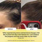 BondiBoost HG Lock Drops Daily Hair Serum for Women – Non-Greasy, Reduces Hair Thinning, Stimulates Scalp, Supports Thicker Fuller Hair – Vegan, Color-Safe, Lightweight for All Hair Types & Textures