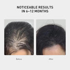0.9% KX-826 KINTOR Hair Growth Spray,Strengthen Hair Nourish Hair follicles,Hair Care Products for Sparse Hair and Oily Hair Men&Women,240ml,Pro