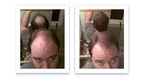 Hair Building Fiber. Cover Bald Spot and Thinning Hair Instantly. 10X Fuller Hair. All-Natural, Organic Hair Loss Concealer. Trial Size (10-Day Supply). Medium Brown