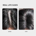 KINTOR 0.9% KX-826 DHT Blocker for Men & Women Hair Growth,Hair Growth Products Foam 60ml Pro