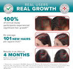 iGrow Laser Hair Growth System - Red Light Therapy, Clinically Proven, FDA Cleared Laser Cap Hair Growth for Men & Women