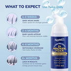 5% Minoxidil Foam for men and women, Extra Strength Hair Regrowth Treatment for Thinning Hair and Hair Loss, Hair Follicle Health – Thicker, Fuller Hair Growth Solution 6 FL.OZ