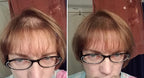 Quick Fix For Thinning Hair and Bald Spot. Get 10X Fuller Hair Instantly. All-Natural Hair Building Fiber For Hair. Trial Size (10-Day Supply). Light Brown