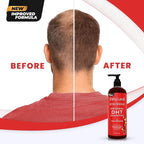 DHT Blocker Shampoo and Conditioner - For Women And Men, Made In USA, Anti-Hair Loss Treatment, With Biotin, Castor Oil, Rosemary Oil and Procapil, For Thinning Hair And Hair Loss