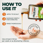 Medicasp Coal Tar Anti-Dandruff Shampoo, Alleviates Symptoms from 1st Wash, Treats Psoriasis, Seborrheic Dermatitis & Itchy Dry Scalp, Fights the Root Cause of Dandruff, Flakes Shampoo, 6 fl oz
