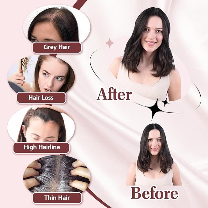 YAMI Real Human Hair Toppers for Women, 12 Inch, Dark Brown, Swiss Lace Base, Medium Density, Full Top Coverage, Clips Attachment