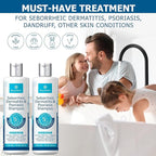 Roycederm Psoriasis Shampoo, Seborrheic Dermatitis Shampoo, Folliculitis Shampoo, Dandruff Shampoo, Scalp Psoriasis & Seborrheic Dermatitis Treatment, Dry Itchy Scalp Treatment