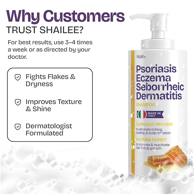 Psoriasis Shampoo for Eczema, and Folliculitis Treatment - Seborrheic Dermatitis Antifungal Shampoo for Ringworm, Acne, Flaking, Dry & Itchy Scalp Treatment - Psoriasis Relief with Manuka Honey