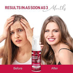 5% Minoxidil Foam for Women, Hair Regrowth Treatment for Thinning Hair and Hair Loss, Lightweight Non-Greasy Formula, Dermatologist Recommended, 2 × 60g (2-Month Supply)