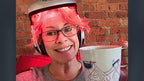 iGrow Laser Hair Growth System - Red Light Therapy, Clinically Proven, FDA Cleared Laser Cap Hair Growth for Men & Women