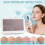 Skin Analysis Machine, 12 Inch LCD Screen Rechargeable Digital Scalp Camera for Hair Analysis, 50x/200x Dual Heads, Skin Health Detection Use for Home, Salon and Spa