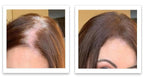 Caboki 10X Hair Powder for Thinning Hair Auburn, TALC-Free, Healthful Formula, Instant Fuller Hair, Flawless Roots, Rain and Sweat Resistant, Easy to Use, Men Women
