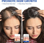 HIQILI Rosemary Oil for Hair Growth, Add to Shampoo & Conditioner, 100% Pure Undiluted - 16 Fl Oz
