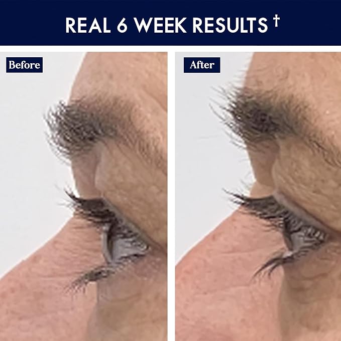 SugarbearPRO LashCare™ + BrowCare™ Vitamin Serum Duo | Peptides, MSM & Biotin | 3-Month Supply Each | Vegan Formula for Fuller, Healthier-Looking Lashes & Brows