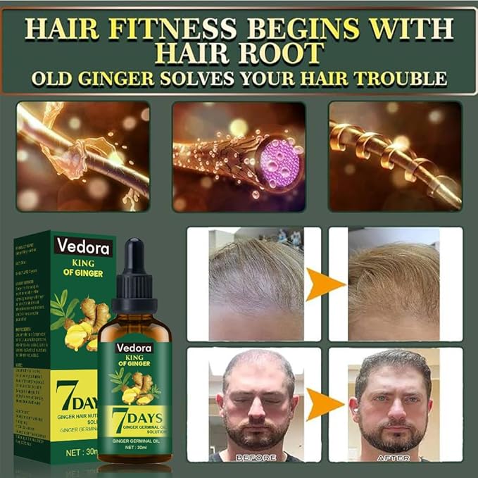 Vedora Ginger Oil for Hair Growth - Biotin Hair Growth Serum, 100% Pure Natural Ginger Essential Oil - Promotes Stronger, Thicker, Longer Hair in Women & Men - 2.0 Fl Oz / 60ML (2 PCS)