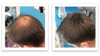Hair Building Fiber. Cover Bald Spot and Thinning Hair Instantly. 10X Fuller Hair. All-Natural, Organic Hair Loss Concealer. Trial Size (10-Day Supply). Medium Brown