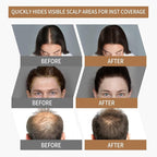 Sevich Hairline Powder 2.0，Instantly Conceals Hair Loss, Root Touch up Powder, Hair Shadow Toppers for Women & Men Thinning Gray Hair, Windproof & Sweatproof, 48H Makeup Lasting, Medium brown