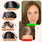Human Hair Toppers for Women with Thinning Hair Real Human Topper Crown No Bangs 10 Inch #1B Natural Black
