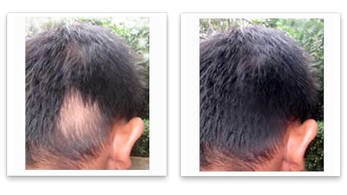 Caboki 10X Hair Powder for Thinning Hair, Light Brown - For Men & Women, TALC-Free, Healthful Formula, Instantly Fuller Hair, Flawless Roots, Rain and Sweat Resistant, Easy to Use