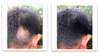 Caboki 10X Volumizing Hair Powder for Thinning Hair: Root Touch Up, Fill in Hairline & Edges, Cover Bald Spots and Gray For Men and Women. TALC-Free,Dark Brown