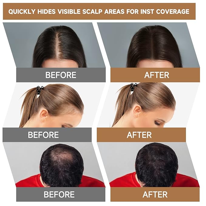 2 Pack Root Touch Up Shadow Powder, Gray Hair Cover Up, Women Color Root Coverage Powder for Thinning Grey Hairline, Men Instantly Concealer Hair Loss Beard Line Eyebrow, Gray