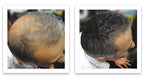 Trial Size - Eliminate Bald Spot and Thinning Hair Instantly. Make Thin Hair Look 10X Fuller. All-Natural Hair Thickening Fiber. Salt & Pepper - Dark