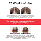 Red Light Therapy for Hair Growth,Infrared Red Light Hair Therapy Hat,Laser Hair Growth Cap Detachable,Support for Men & Women