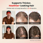 CAYAMA Red Light Therapy Cap, Laser Hair Growth Cap Red Light Therapy for Hair Growth – 528-LEDs