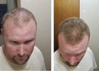 Quick Fix For Thinning Hair and Bald Spot. Get 10X Fuller Hair Instantly. All-Natural Hair Building Fiber For Hair. Trial Size (10-Day Supply). Light Brown